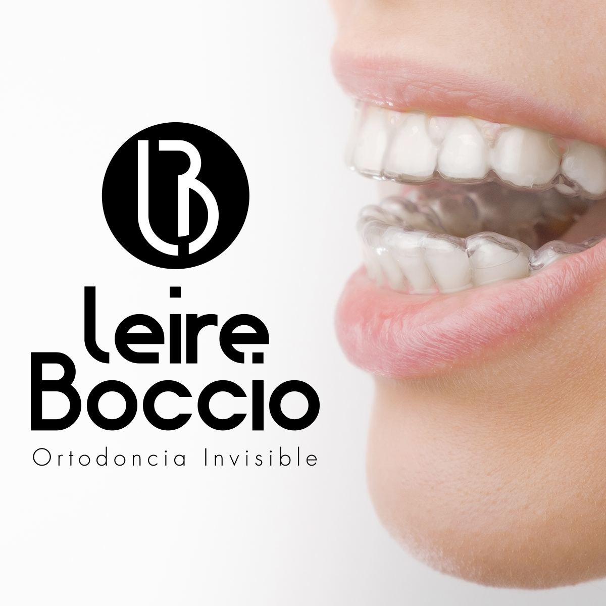 Ortodoncia Invisible Madrid segura