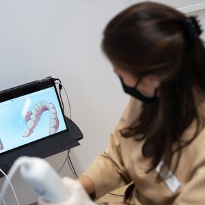 Invisalign Madrid | Planificación Caso Antes y Después