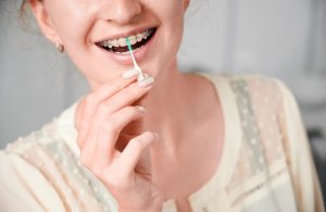 Como cepillar dientes con brackets
